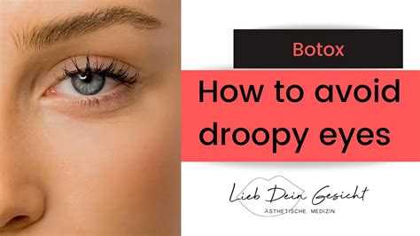 avoid touching, rubbing,. . I accidentally rubbed my eye after botox